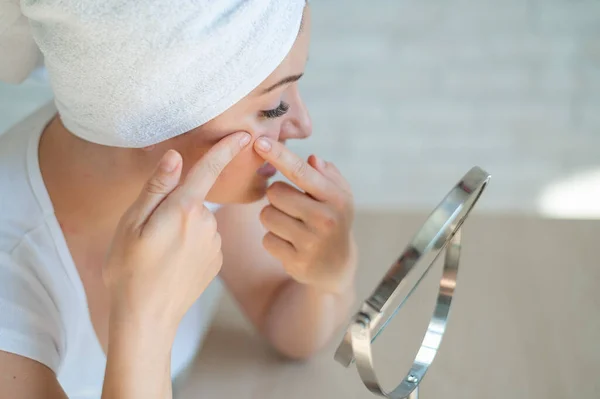A woman with a white towel on head looks in the mirror and squeezes a pimple on cheek. A girl with hormonal problems does facial cleansing at home. Teen acne. Dermatologist himself in isolation. — Stock Photo, Image