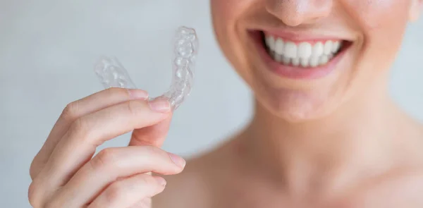 Close-up de dentes transparentes de silicone ortodôntico aligner em mãos femininas. Mulher irreconhecível segurando um retentor de noite removível. Suporte para clareamento dos dentes. O sorriso perfeito. Foto cortada. — Fotografia de Stock