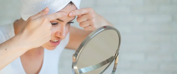 Una mujer molesta se mira en el espejo y aprieta una espinilla en la frente. Una chica con problemas hormonales limpia su cara después de una ducha. Acné adolescente. Él mismo es dermatólogo. Problema de piel . — Foto de Stock