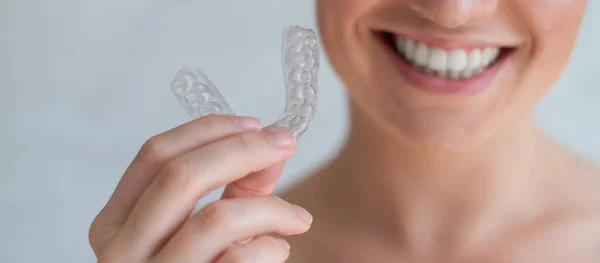 Close-up de dentes transparentes de silicone ortodôntico aligner em mãos femininas. Mulher irreconhecível segurando um retentor de noite removível. Suporte para clareamento dos dentes. O sorriso perfeito. Foto cortada. — Fotografia de Stock