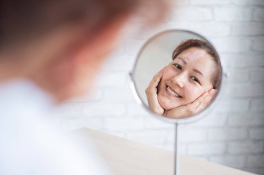 Vitiligo 'su olan bir kadın aynaya bakar. Masadaki yansıma alnında beyaz bir leke olan bir kız. Otoimmün hastalık. Cilt pigmentasyonu eksikliği.