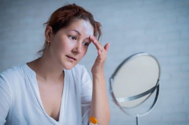 Vitiligo 'su olan beyaz bir kadının portresi güneş kremi kullanıyor. Alnında beyaz pigment lekesi olan bir kız aynaya bakar ve krem sürmüştür..
