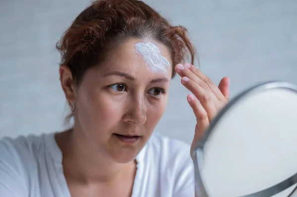 Retrato de una mujer caucásica con vitíligo utiliza protector solar. Una chica con una mancha de pigmento blanco en la frente se mira en el espejo y se unta con crema. — Foto de Stock