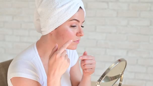 Μια λευκή γυναίκα με λευκή πετσέτα στο κεφάλι κοιτά στον καθρέφτη και συνθλίβει σπυράκια. Προβληματικό δέρμα κατά τη διάρκεια της περιόδου. Ακμή και υπερανδρογονισμός λόγω ορμονικών διαταραχών. — Αρχείο Βίντεο