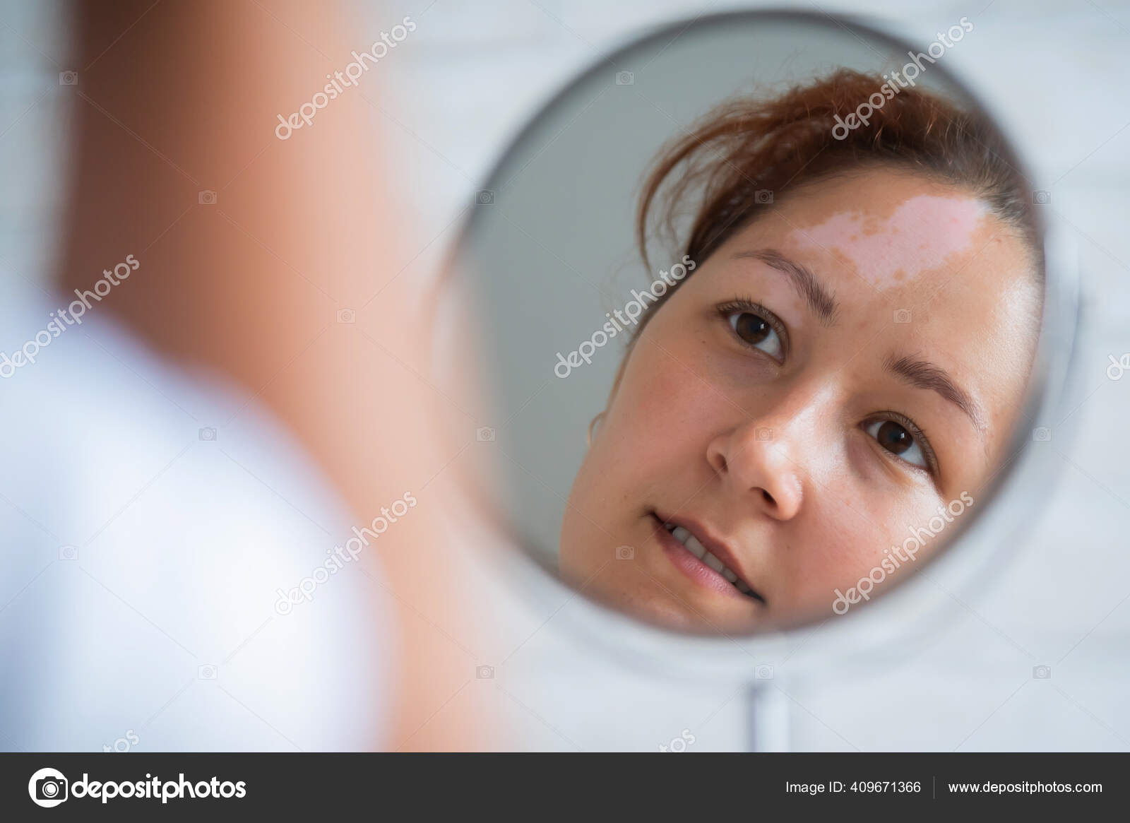 Une femme avec du vitiligo regarde dans le miroir. Réflexion dans ...