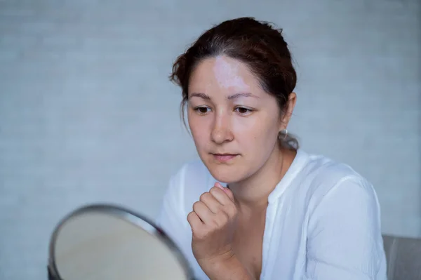 Retrato de una mujer blanca con vitiligo. Una chica con una mancha de pigmento blanco en la frente se mira en el espejo. Enfermedad autoinmune que afecta a la piel. — Foto de Stock