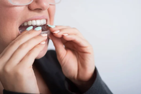 Femme d'affaires met sur des retenues transparentes pour redresser les dents — Photo