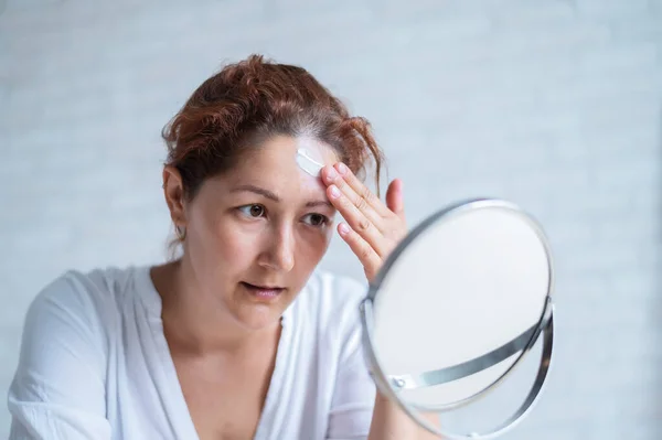 Retrato de una mujer caucásica con vitíligo utiliza protector solar. Una chica con una mancha de pigmento blanco en la frente se mira en el espejo y se unta con crema. — Foto de Stock