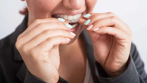 Business woman uses transparent braces to whiten teeth — Stock Photo, Image