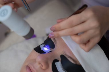 Kirpik uzatma prosedüründen geçen bir kadın ultraviyole lamba kullanıyor.