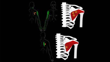 İnfraspinatus kası. Tetik noktaları ve kolunda ve kürek kemiğinde ağrı var. Kolun derin kasları. Siyah arkaplanda vektör resmi.