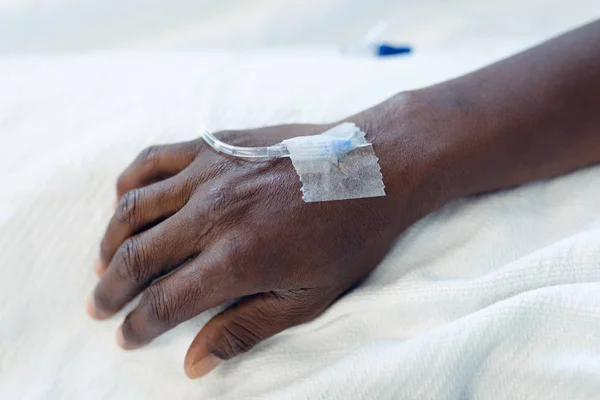 病院の病棟で患者の手に点滴するIvのクローズアップ — ストック写真