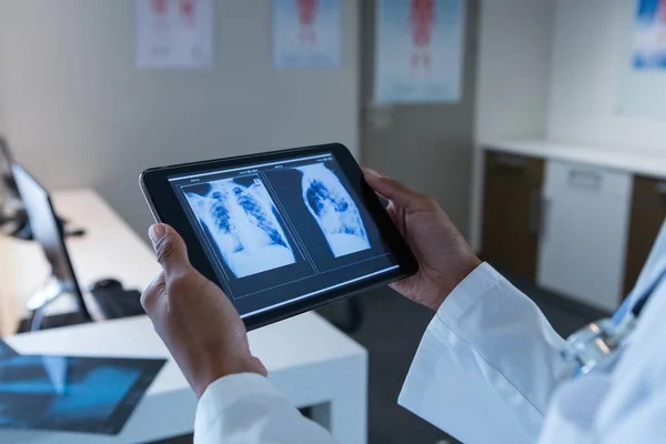 Mid Section Close Female Doctor Examining Ray Digital Tablet Hospital — Stock Photo, Image