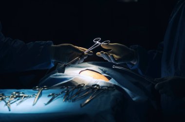 Doktor ve Yardımcısı cerrahlar ekibi kurtarma hasta hastane, acil durum, cerrahi, medikal teknoloji, sağlık kanser ve hastalık kavramı operasyon odasında için