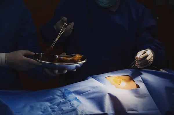 Γιατρός Και Βοηθός Χειρουργοί Εργάζονται Για Διάσωσης Ασθενούς Στο Χειρουργείο — Φωτογραφία Αρχείου