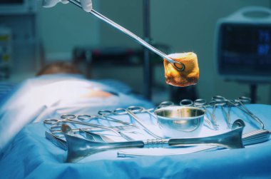 Koruyucu eldiven sterilzed gazlı bez betadin sıvı kurtarma hasta ile hastane, acil durumda, hastalık tedavi kavramı operasyon odasında tutan doktor ve Yardımcısı cerrahlar yardım
