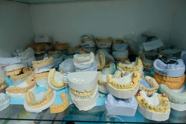 医療キャビネット内の歯科用歯モデル — ストック写真