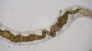 4k mikroskop altında Roundworm