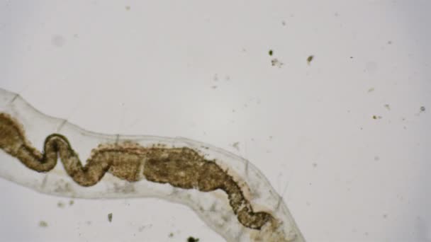 Rondworm Onder Microscoop — Stockvideo