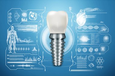 Diş implantı, paslanmaz çelik direk ve yeni teknolojiler içeren hologram. Diş değiştirme konsepti, takma dişler, fotokopi alanı. 3B illüstrasyon, 3B grafikler