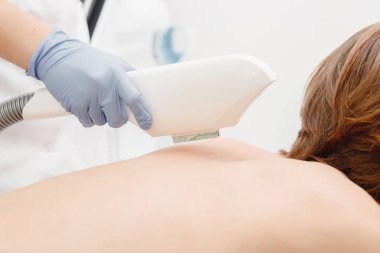Adam epilasyon lazer saç kaldırma arka yordamı tedavi