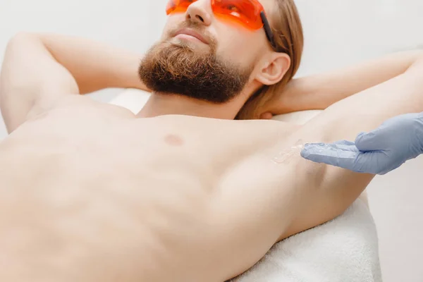 Trattamento di procedura di depilazione laser di depilazione maschile — Foto Stock