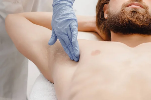 Trattamento di procedura di depilazione laser di depilazione maschile . — Foto Stock