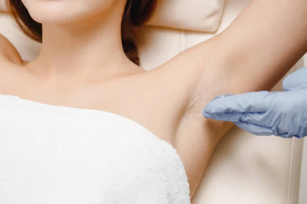 Close-up ketiak. Laser hair removal underarms. Spesialis menerapkan gel — Stok Foto