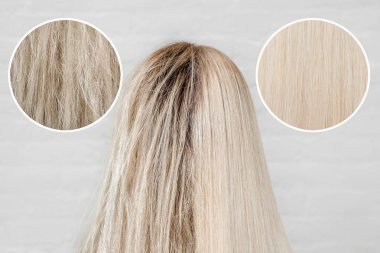 Hasta, kesilmiş ve sağlıklı saç bakımı keratin. Tedavi öncesi ve sonrası kepek