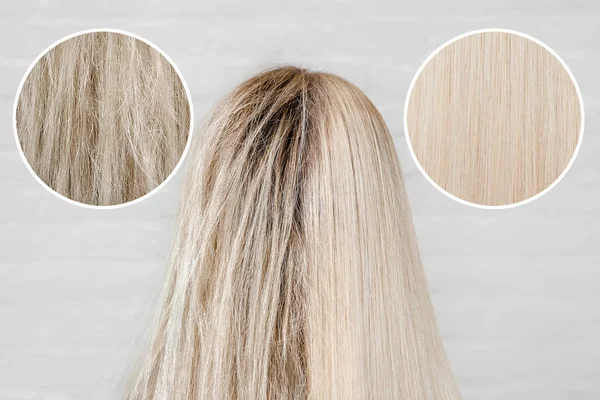 Hasta, kesilmiş ve sağlıklı saç bakımı keratin. Tedavi öncesi ve sonrası kepek