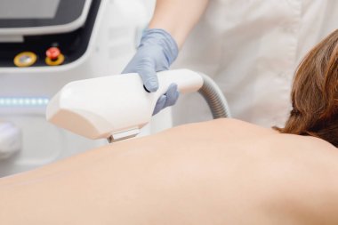 Erkek sırtında lazer epilasyon. Özgüven, güzellik ve sağlık kavramı. Yakın çekim