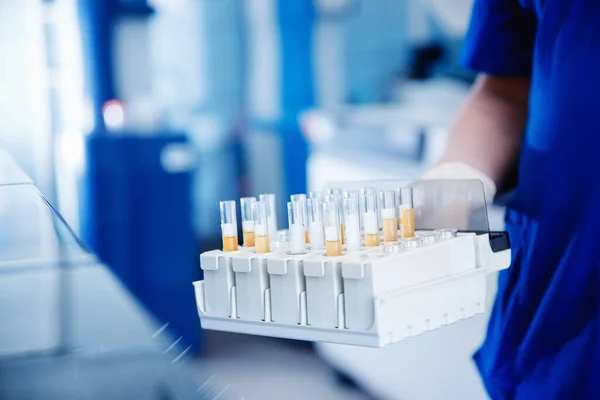 Wetenschapper downloadt bloedmonsters om DNA, hiv, aids, virus te testen op laboratorium — Stockfoto