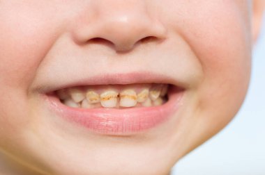 Çocuk bakıcılarını kapat.