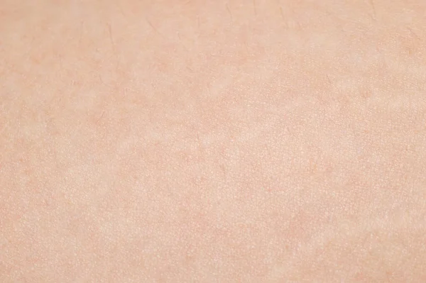 İnsan derisinin makrosu. İnsan deri dokusu