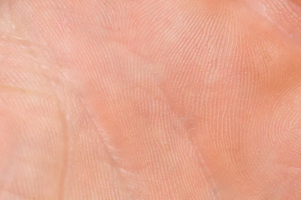 Macro Human Skin Human Skin Texture — Stock Photo, Image