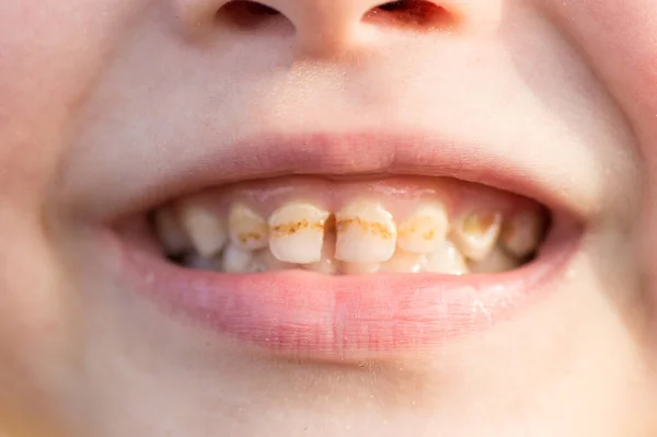 Çocuk bakıcılarını kapat.