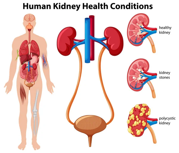 Menselijke Nieren Gezondheidsvoorschriften Illustratie — Stockvector