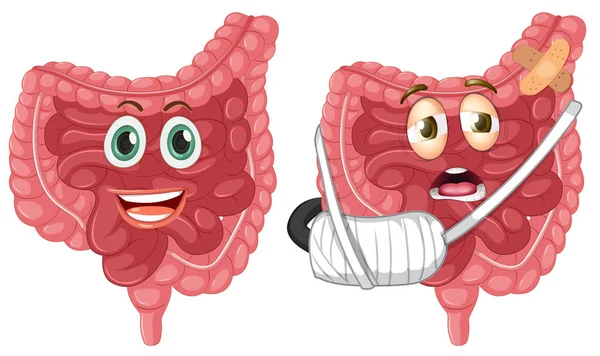 Conjunto Ilustración Del Intestino Sano Lesionado — Archivo Imágenes Vectoriales