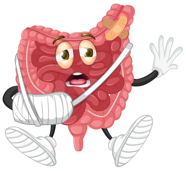 Una Lesión Intestino Sobre Fondo Blanco Ilustración — Vector de stock