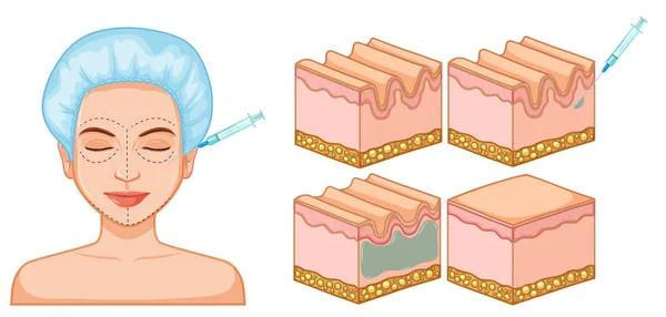 女士面部和皮肤肉毒杆菌插图 — 图库矢量图片