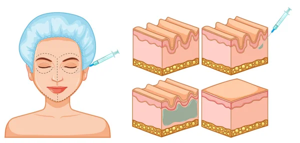 Senhora Facial Pele Botox Ilustração — Vetor de Stock