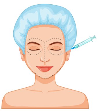 Enjeksiyon illüstrasyon kadın botox dolgu cilt