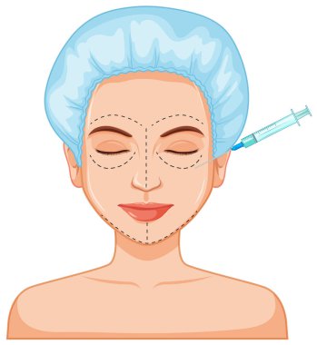 Yüz botox dolgu enjeksiyonu illüstrasyon cilt