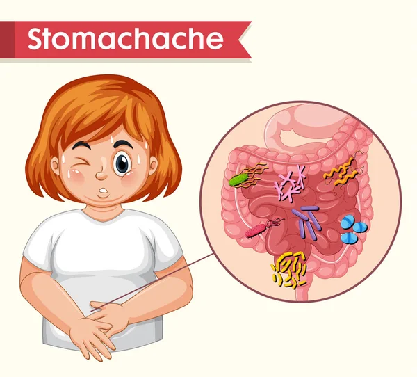 Ilustración médica científica del dolor de estómago — Vector de stock