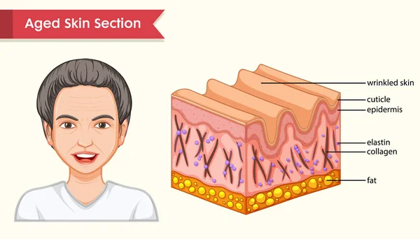 Illustrazione medica scientifica della pelle invecchiata con rughe — Vettoriale Stock