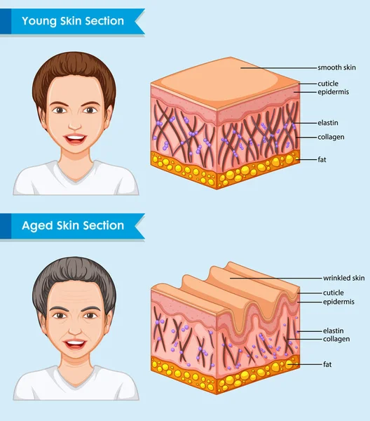 Illustrazione medica scientifica della pelle giovane e invecchiata — Vettoriale Stock