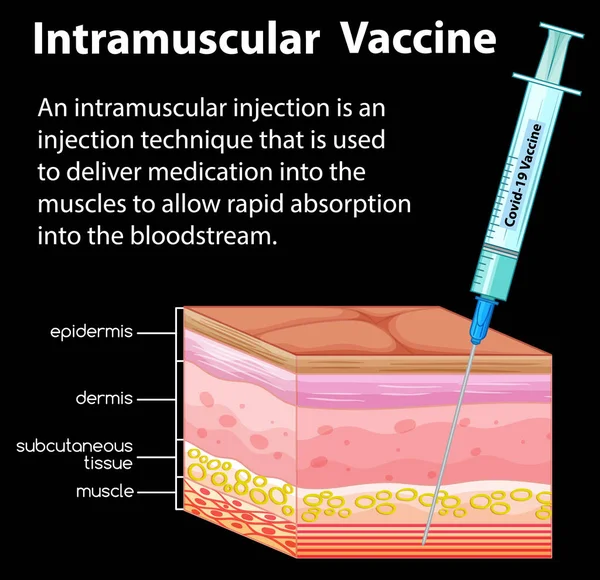 Vetor Informação Sobre Ilustração Injeção Intramuscular —  Vetores de Stock