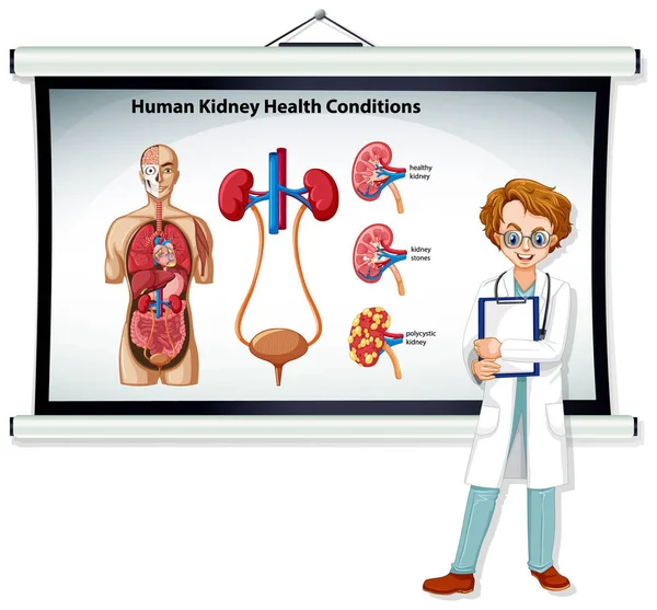 Human Kidney Health Conditions Infographic Doctor Cartoon Character Illustration — Stock Vector