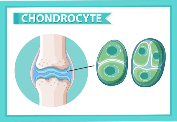 Informační Plakát Ilustrací Chondrocytů — Stockový vektor