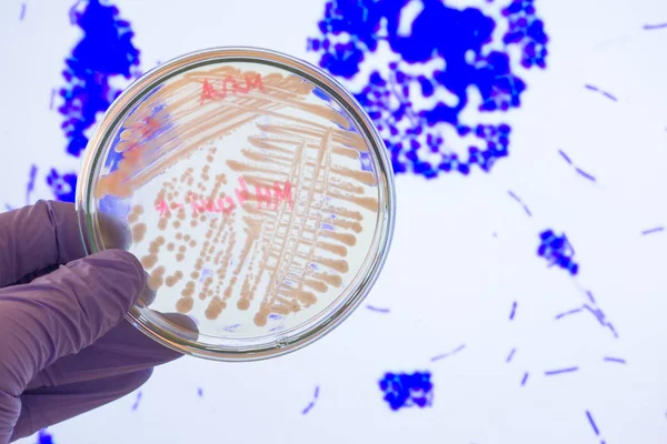 Petri dish with bacteria on the background of photography with a microscope.